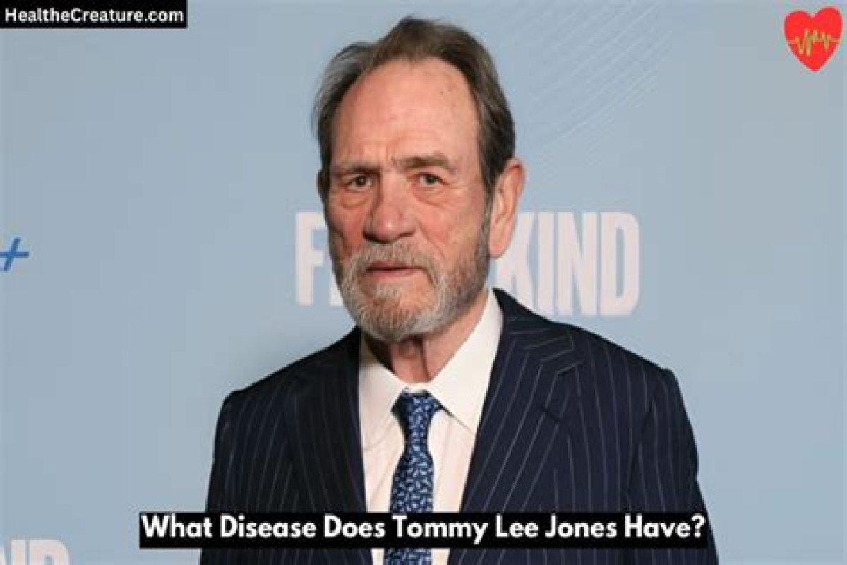 What Disease Does Tommy Lee Jones Have? Understanding His Health Journey
